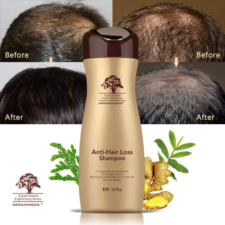 Anti Hair Loss Shampoo & Serum set My Store